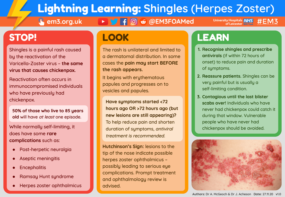 Lightning Learning Shingles — EM3