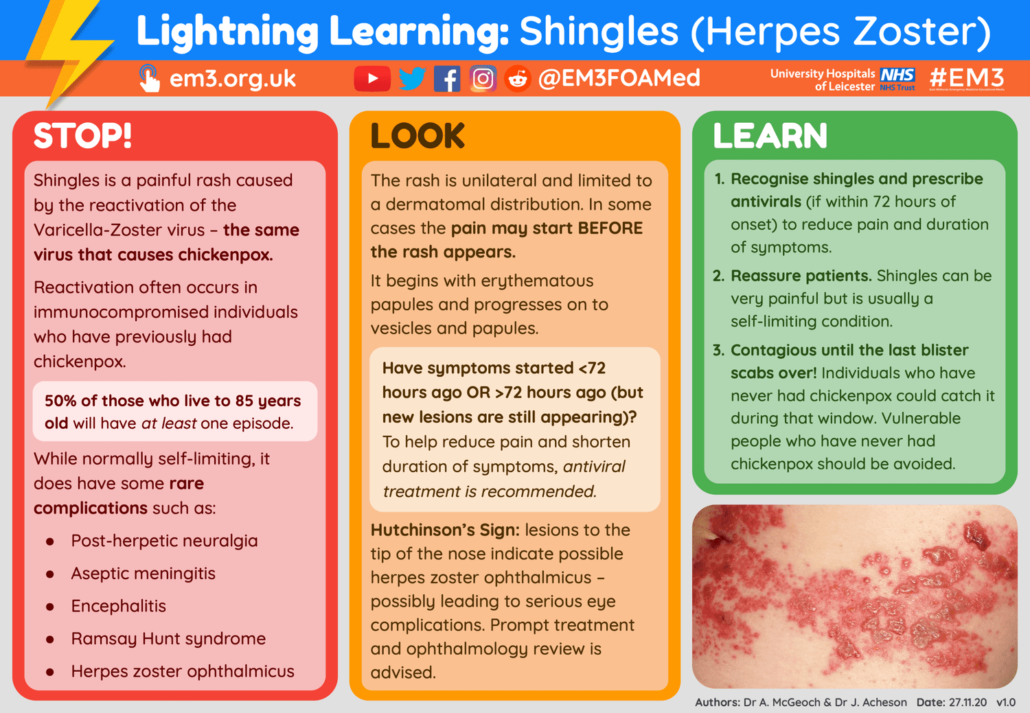 Lightning Learning: Shingles — EM3