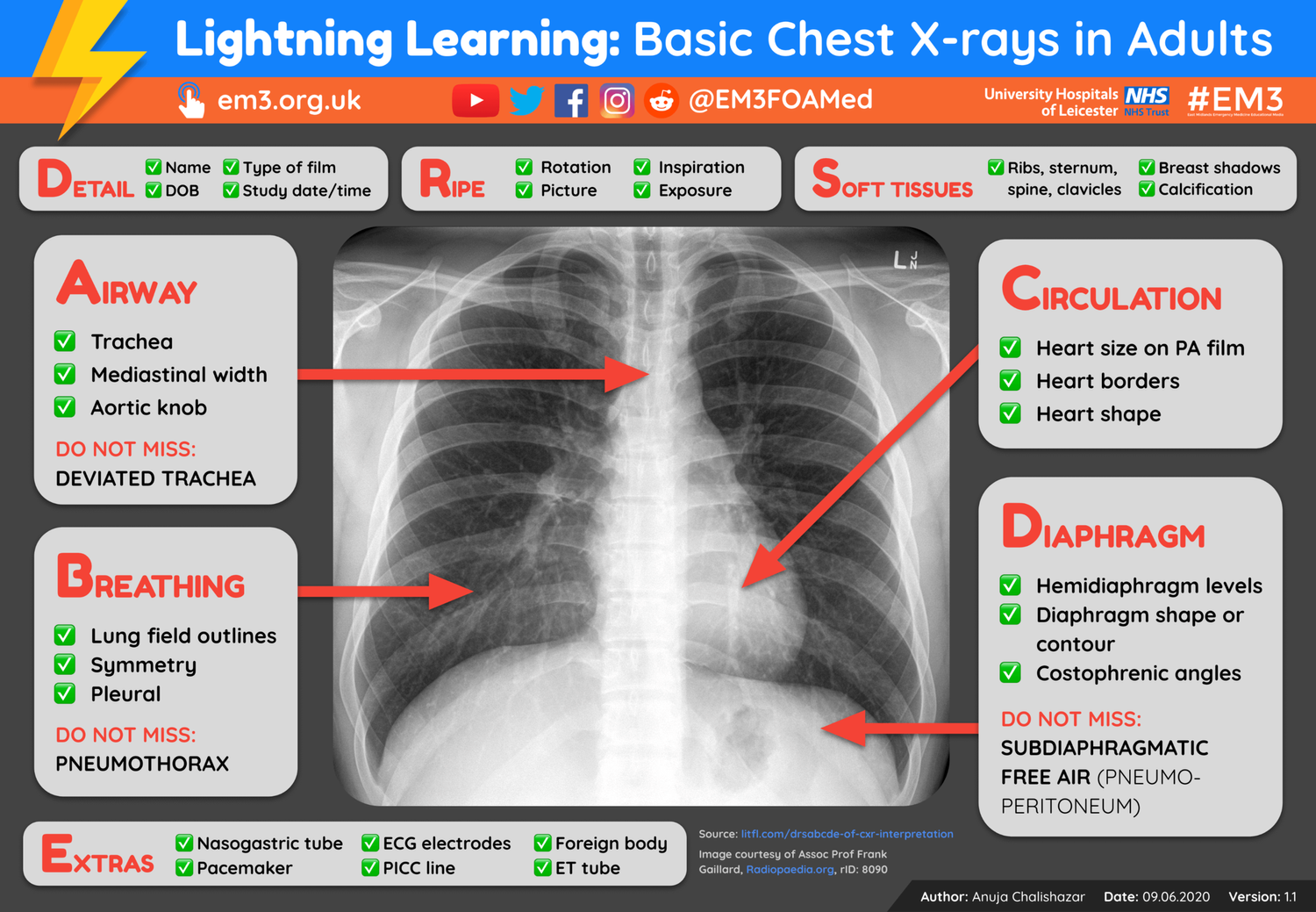 Lightning Learning Basic Chest Xrays in Adults — EM3