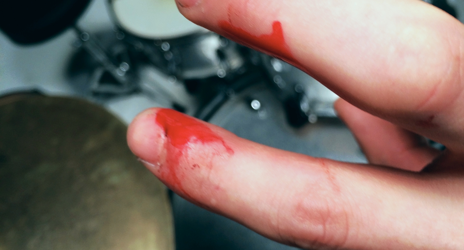 Bloodshed from playing the shit out of my guitar during the "Dear Girlfriend" music video shoot.