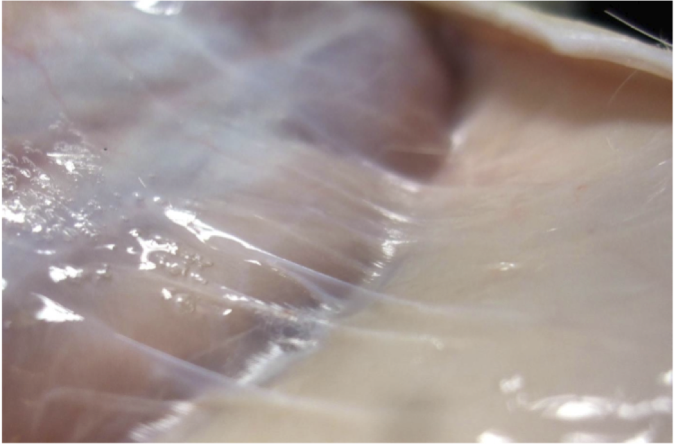 Courtesy Robert Schliep PhD, Fascia Research Group Ulm University