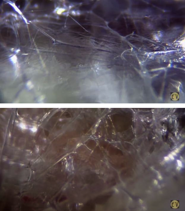 From research film “Muscle Attitudes” – by Dr. Jean-Claude Guimberteau