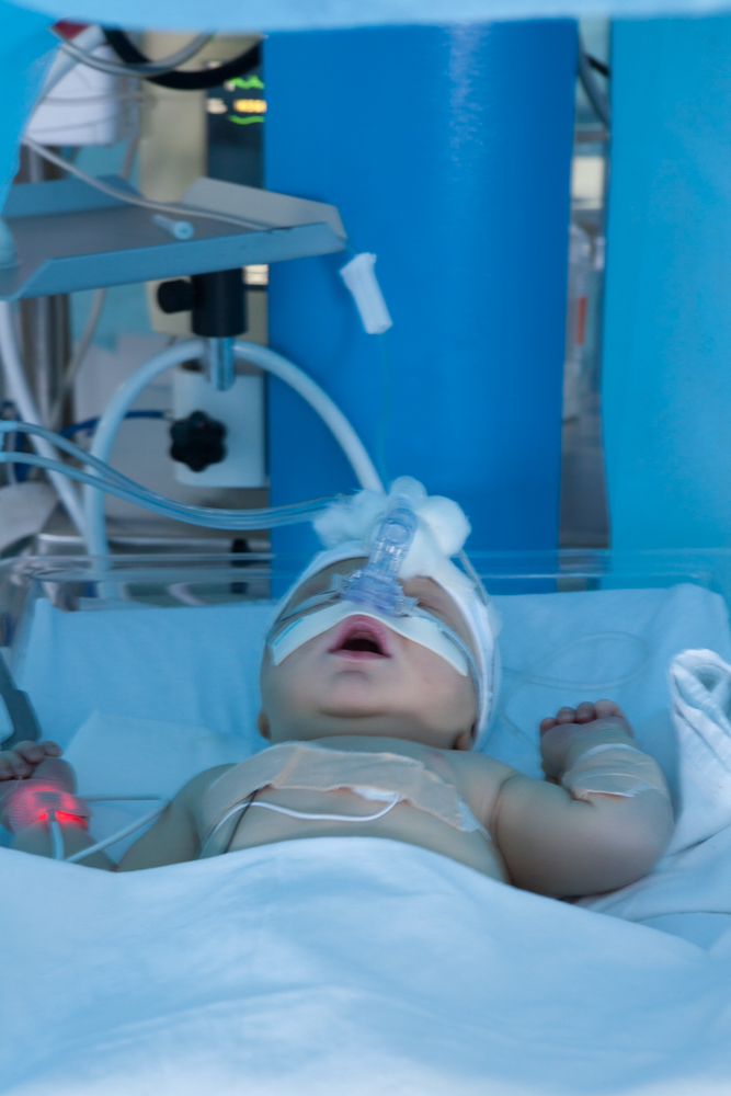 Neonatal Intensive Care Unit, 2011, Tirana, Albania, copyright alketa misja photography