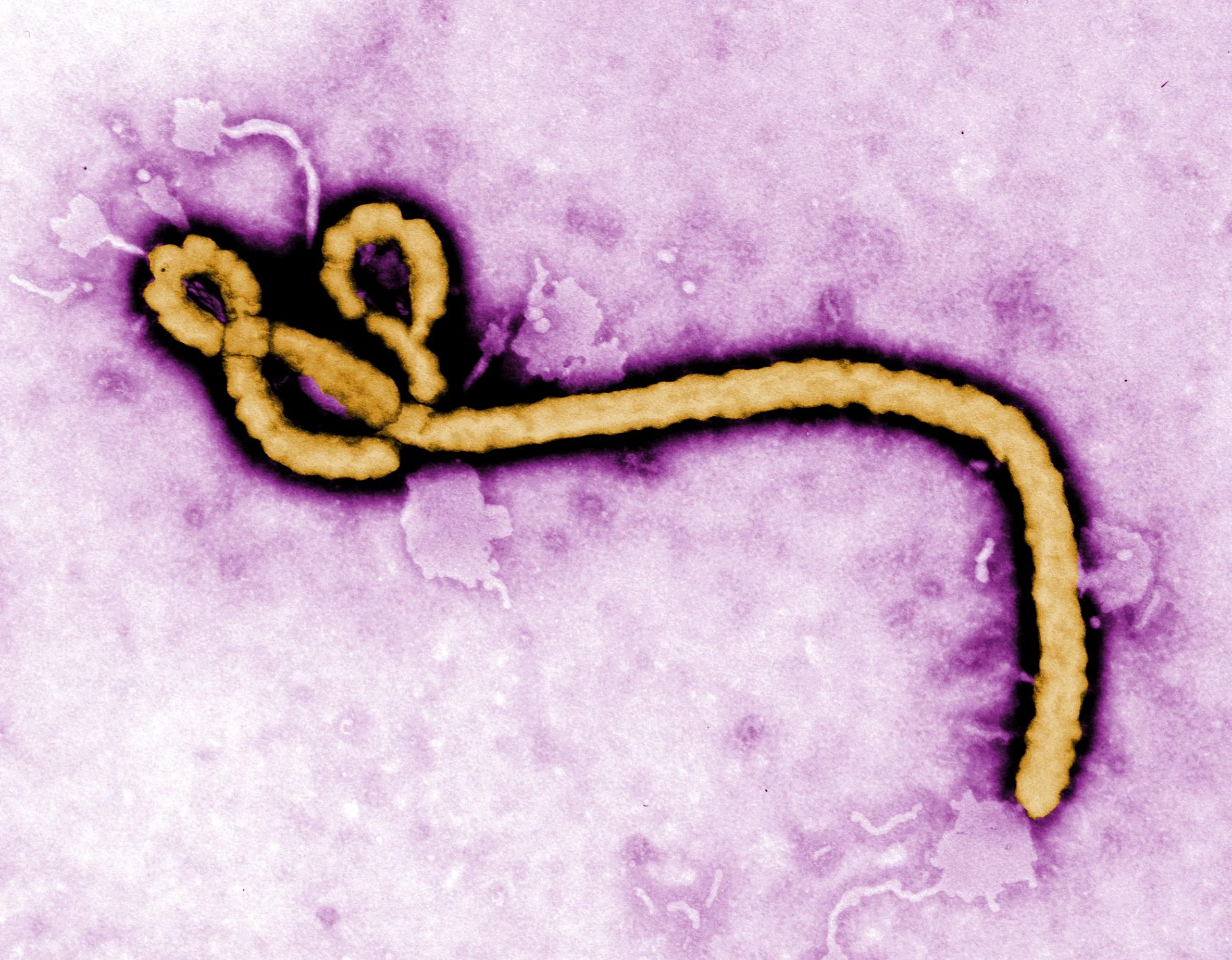 Would an Anthropology of Ebola (help) find its ultimate cure?