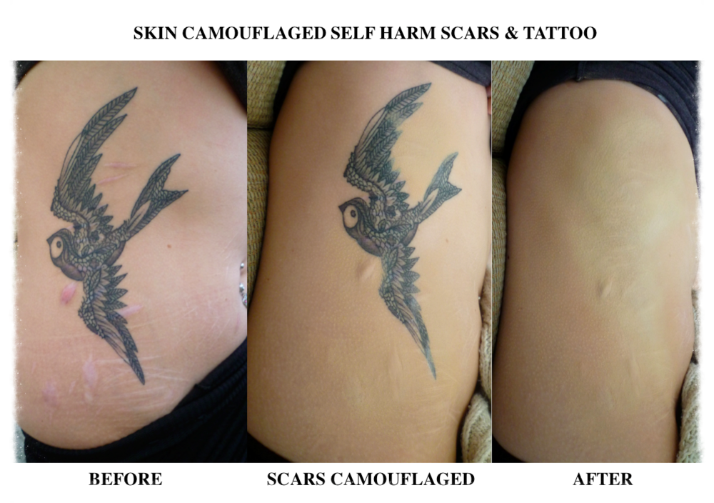 Skin Camouflage — Charlotte Trendell