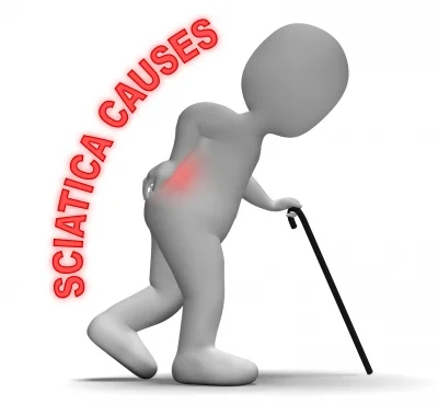 Acupuncture as an effective alternative to Opioids in the treatment of Sciatica 