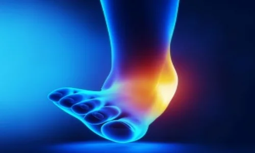 Ankle-Sprain-rs-300x257.jpg