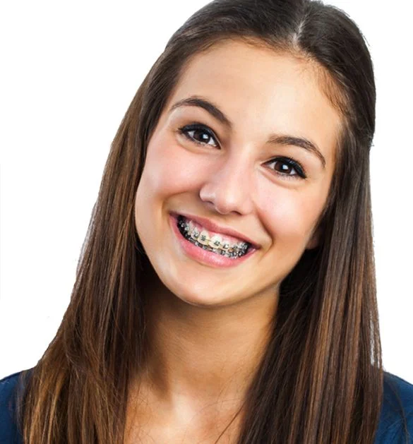 braces.jpg