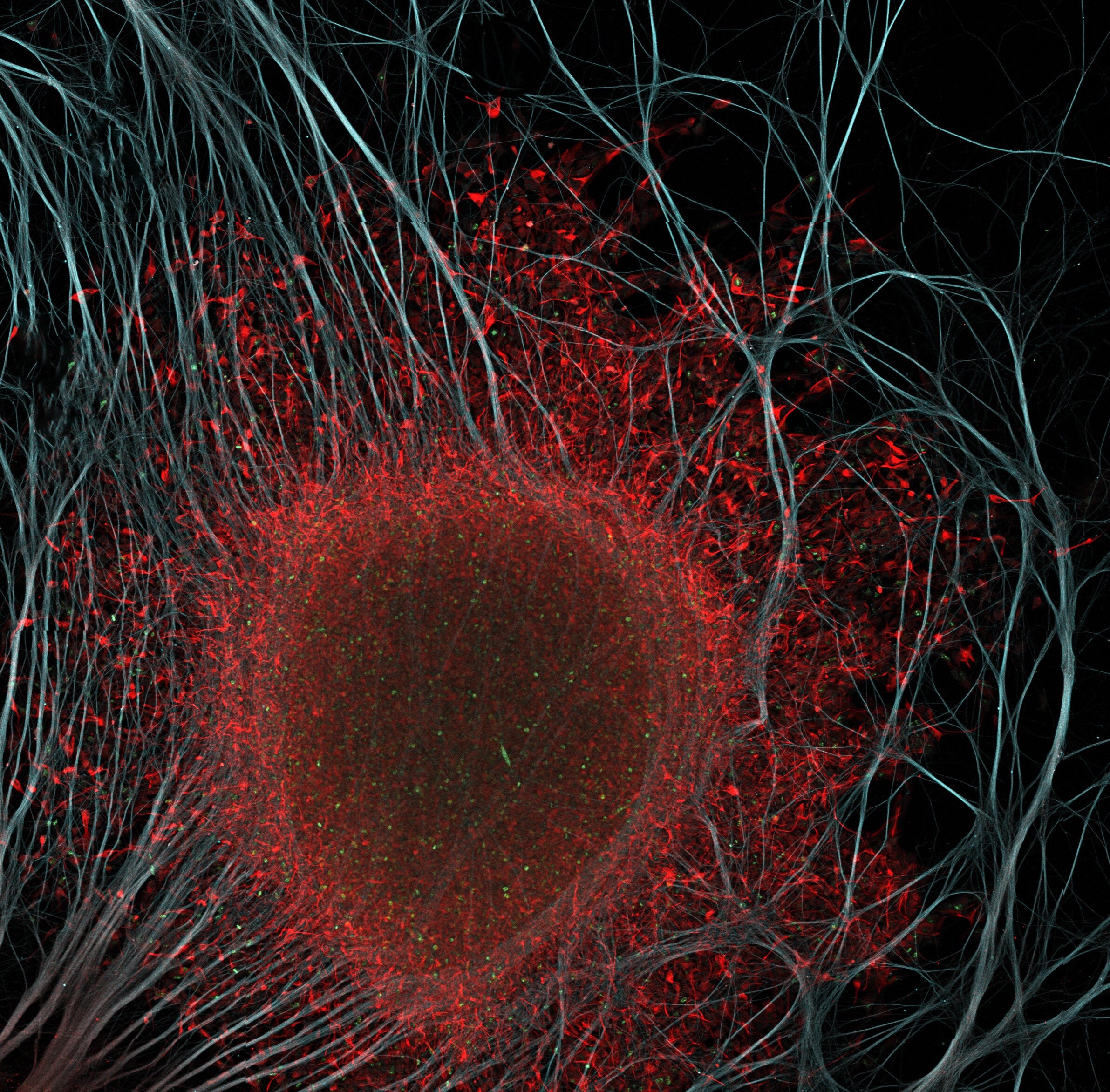 05-01-15-wcr8-exvivo-tumor-dmso-tiled-2_c1%2B2%2B3.cropped+copy.jpg