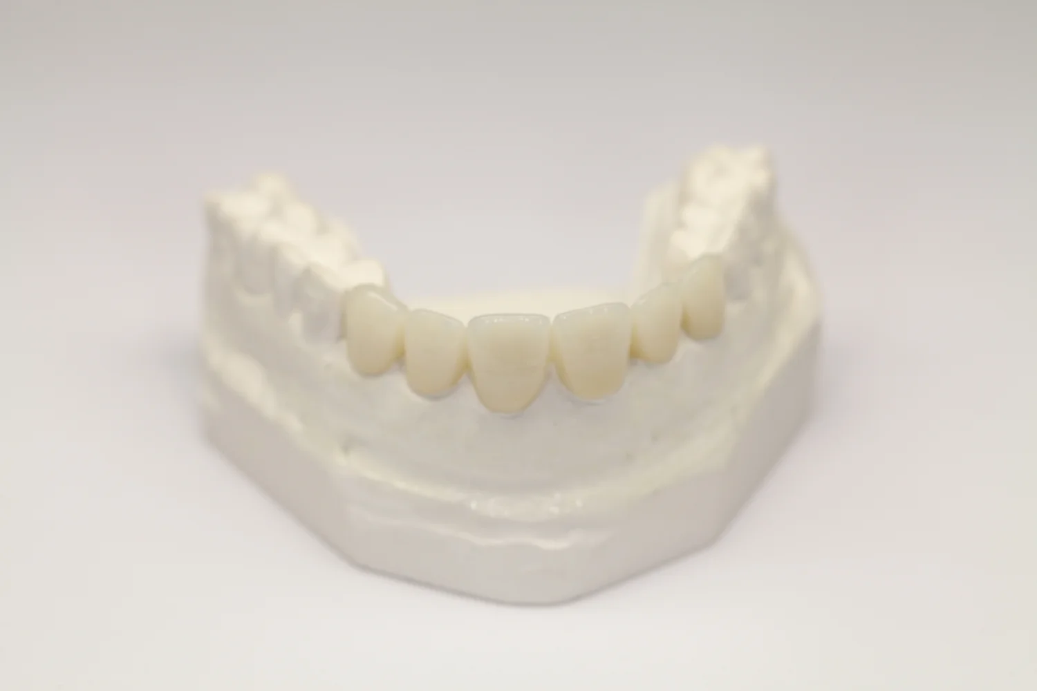 Services & Products — J DENTAL LAB