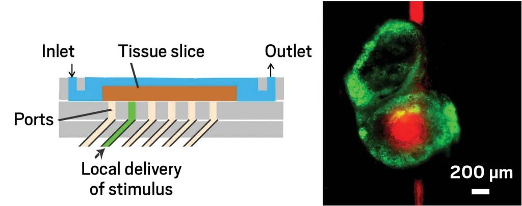 LN-lymphchip-1024x405.jpg