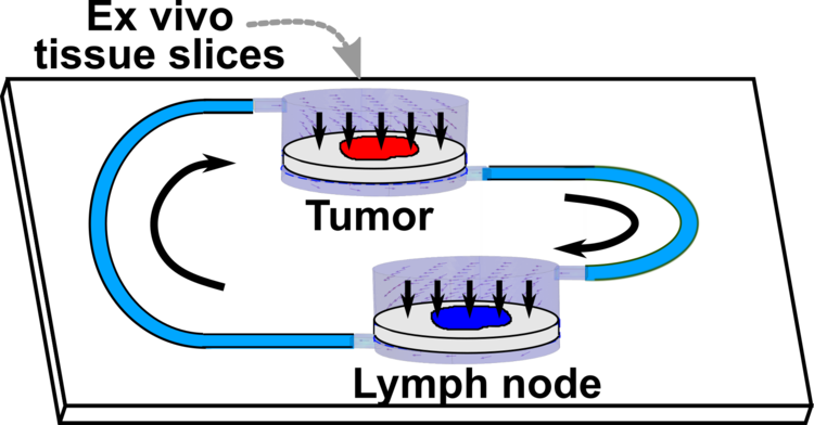 Linking two tissues on-chip for tumor-immunity