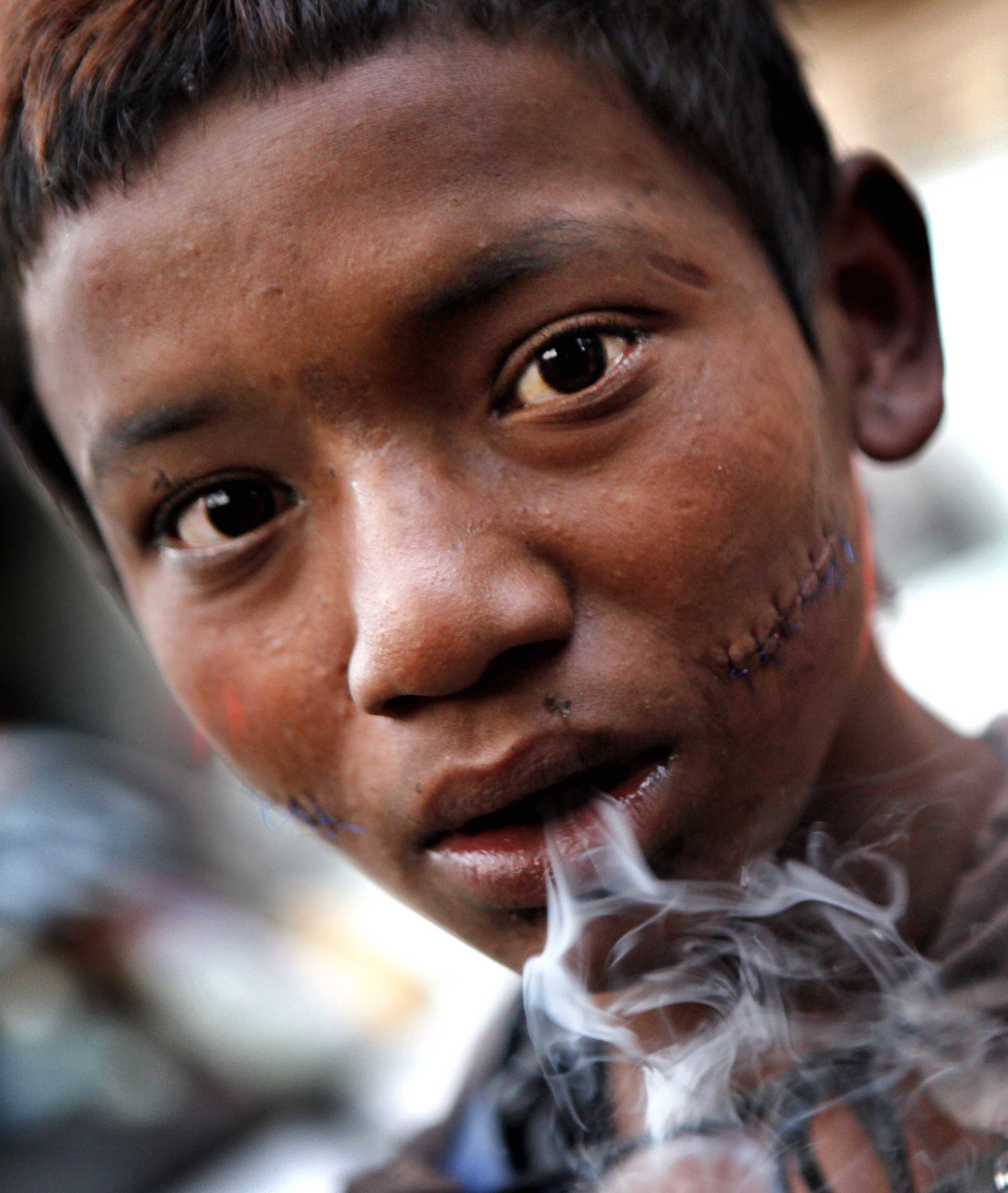  Heroine addict in Nepal 