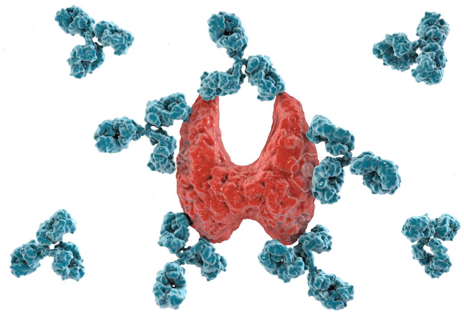 antibodies attacking thyroid tissue.