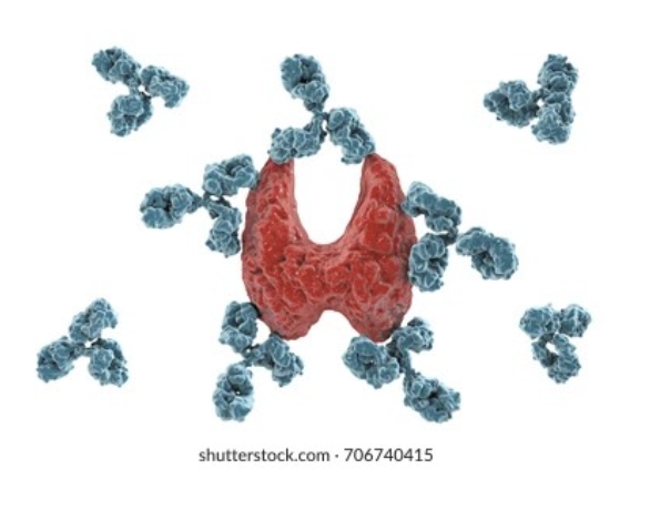 Immune system attacking thyroid tissue