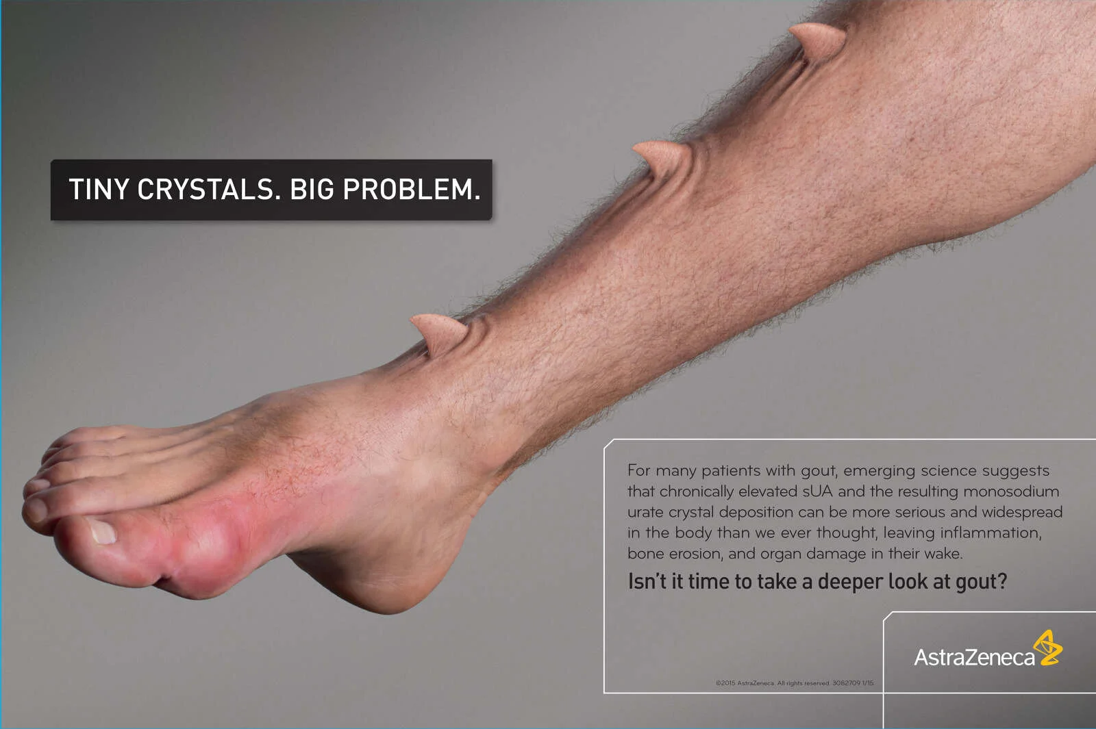  Astra Zeneca Gout  