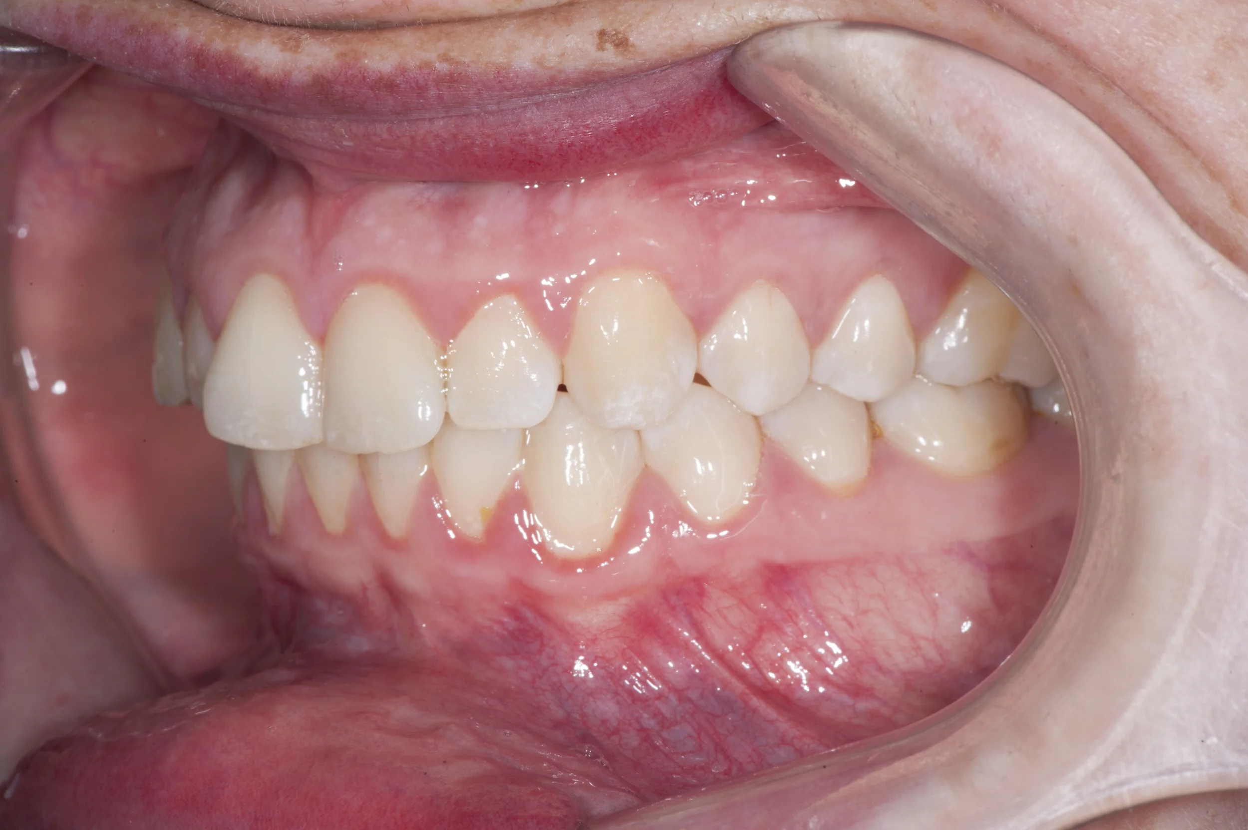 teeth right.jpg
