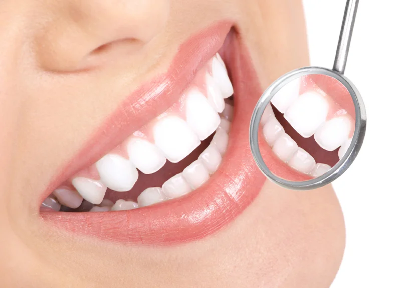 Teeth Whitening.jpg