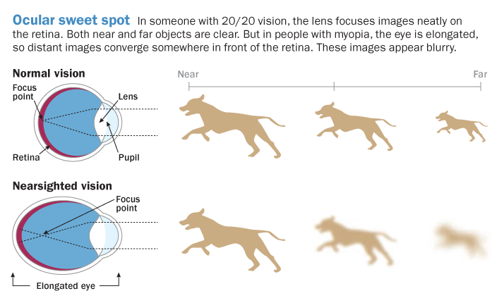 How myopia works