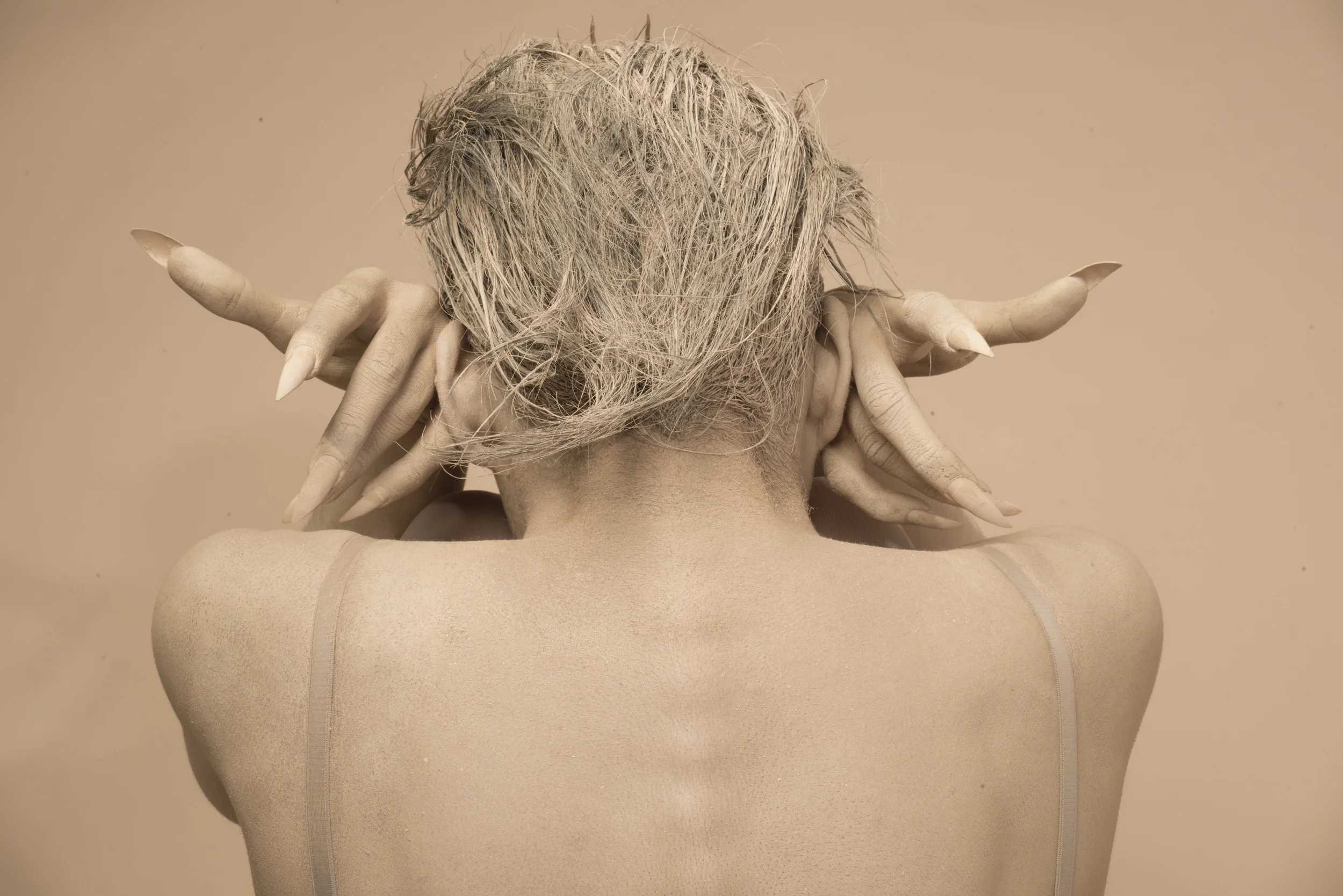 EPIDERMIS