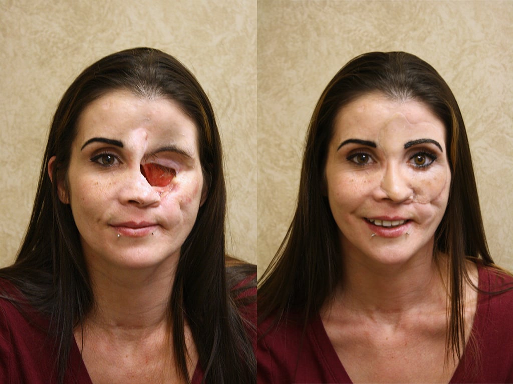 Tanya before and after.