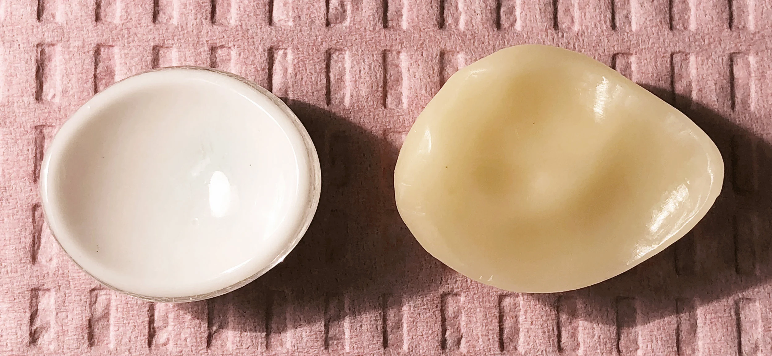 A side by side comparison of the posterior side of the stock eye vs. the custom fitted prosthesis. The shape of the prosthesis is shown in a wax model, to be cast later into the final prosthesis.