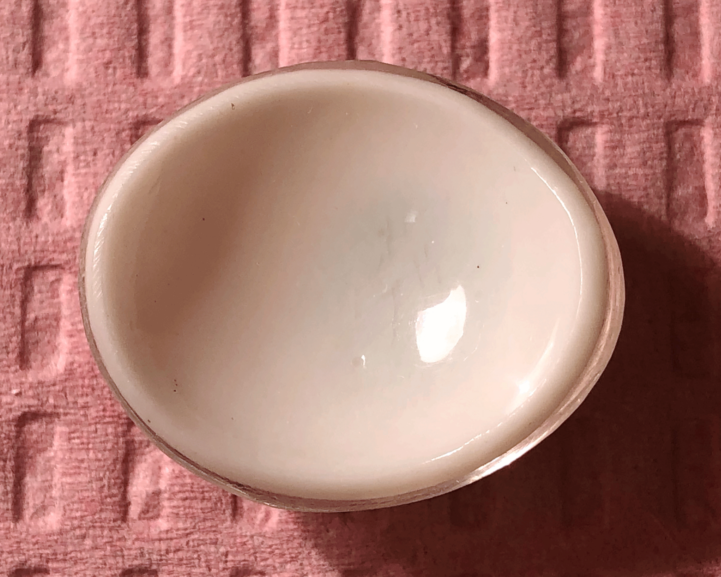 The back side of the ill fitting stock eye with unpolished edges that can cause socket tissue scarring.