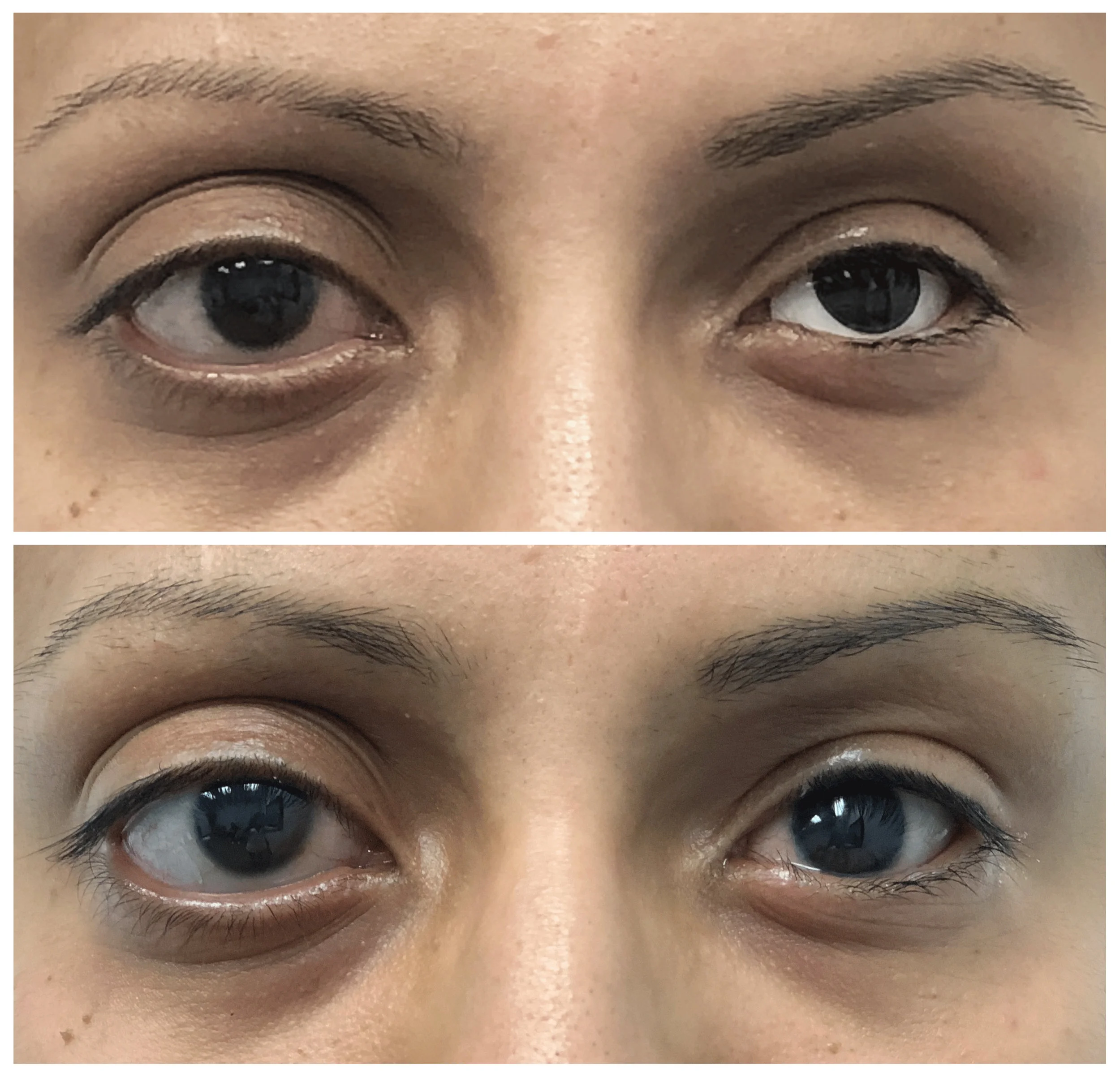 before and after.jpg