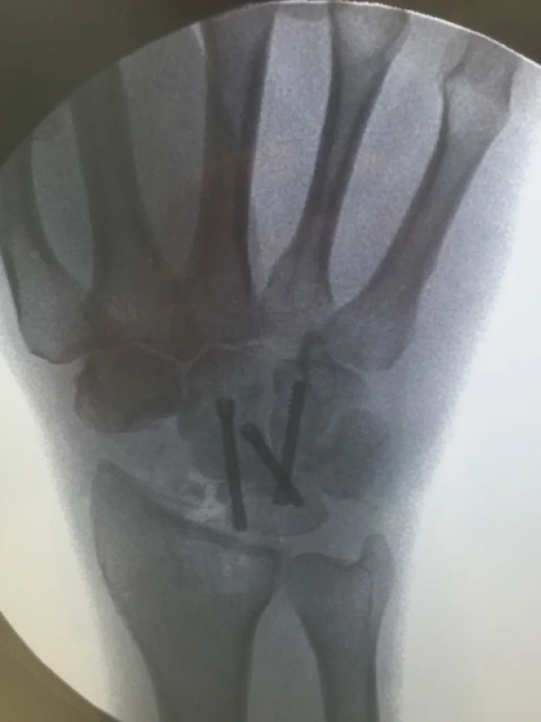 Blank Title Slides for Gray.006.jpeg