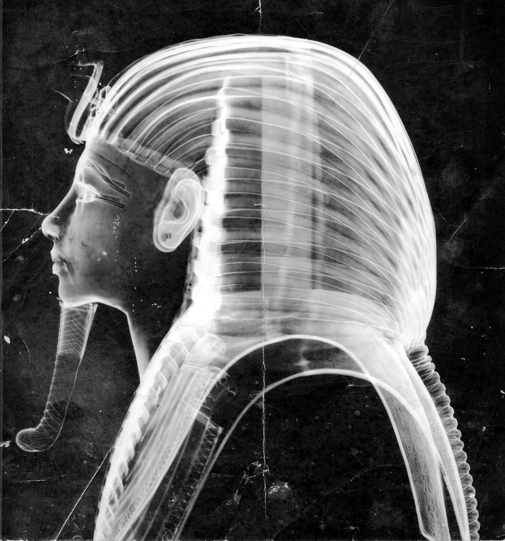 X-Ray 1960s 1B - Photo courtesy of Francis Amin.png