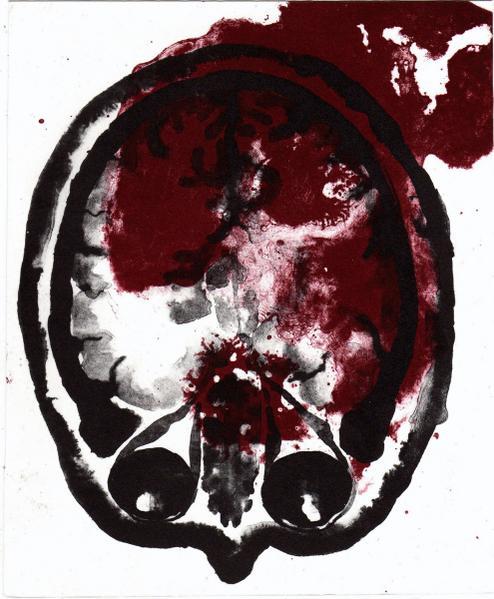 Lithography, 2007