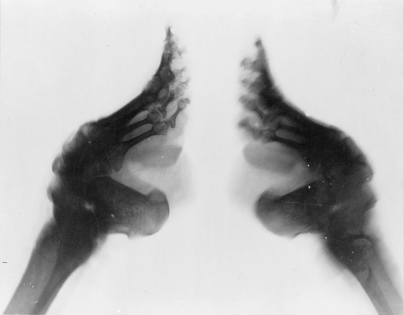 bound feet.jpg