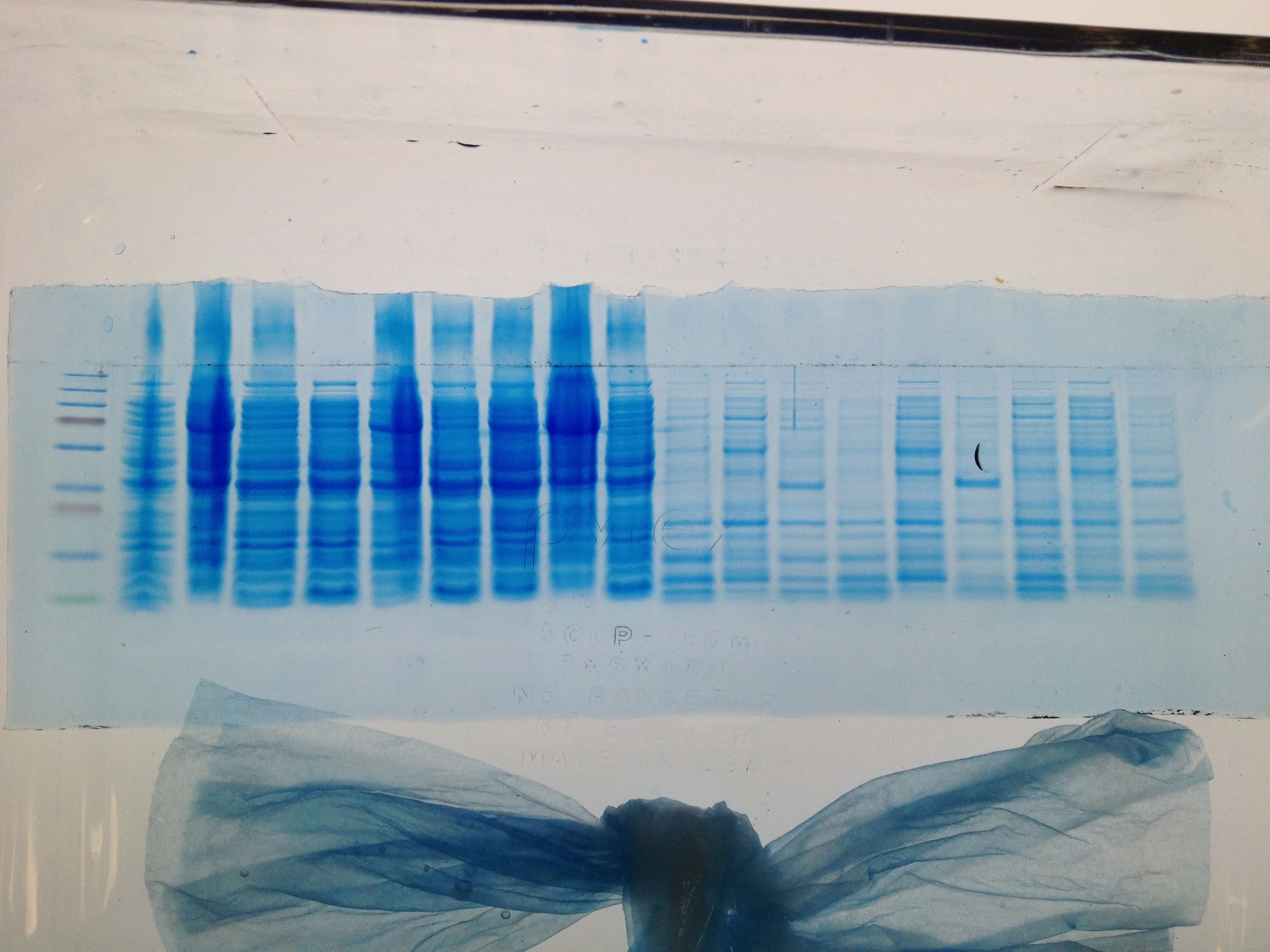 Protein Gel