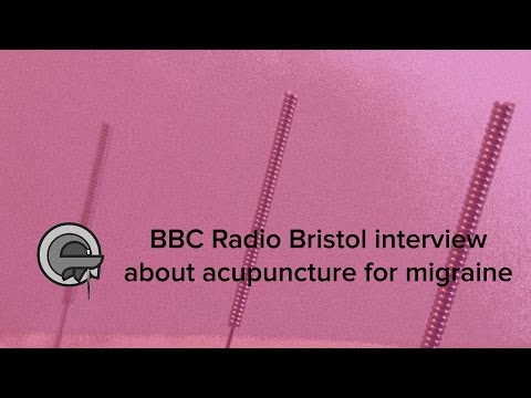 BBC Radio Bristol interview about acupuncture for migraine with Tom Kennedy