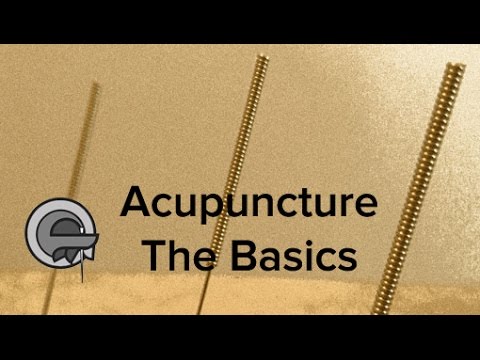Acupuncture treatment - the basics (Tom Kennedy Bristol)