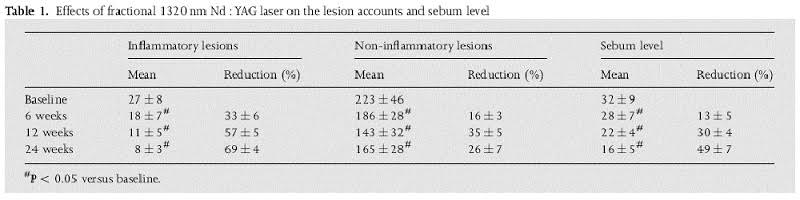 Effect of NdYAG Laser Treatment on Active Acne and Sebum Production (69% Reduction After 24 Weeks)