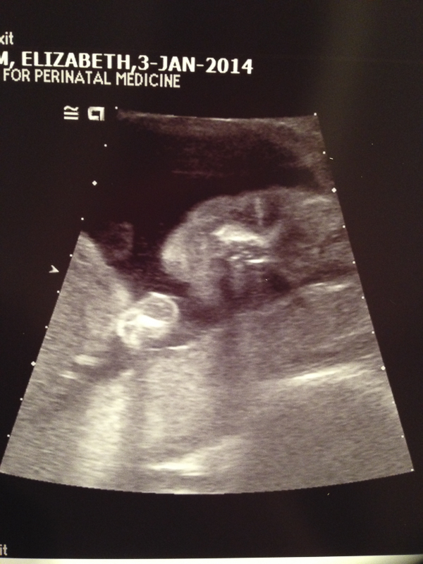 Baby Oliver