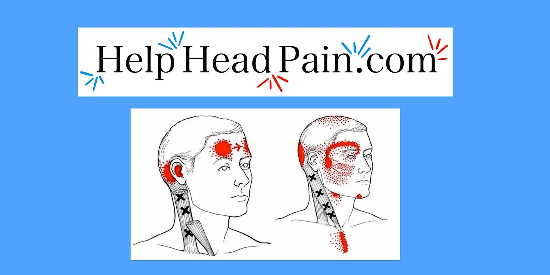 Jaw Tension, Headaches &amp; TMJ Pain: A Self-Relief Workshop 