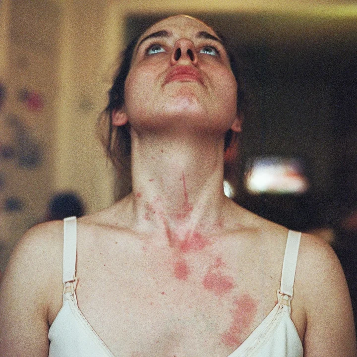 Scratches from breastfeeding, 8 months, Brooklyn, New York 2013