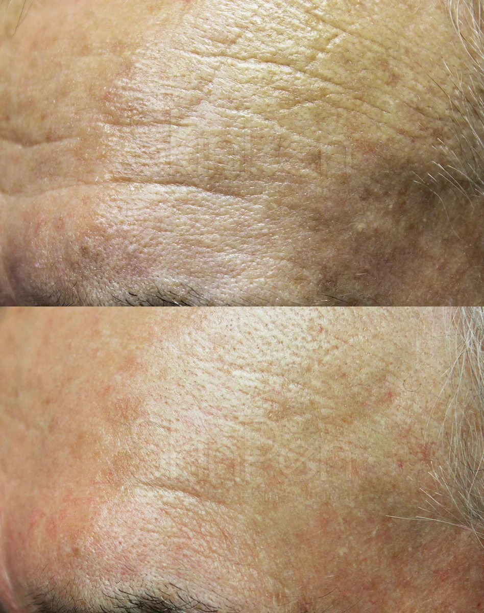Ageing 5 procedures - 6-wm.jpg