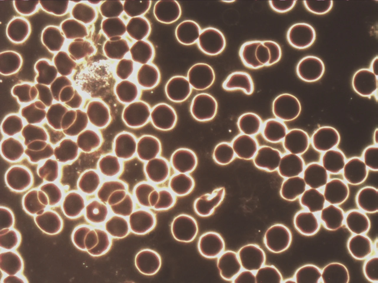What is Live and Layered Cell Analysis? And who is a Microscopist?