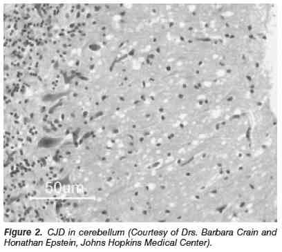 from Epstein and Beecher, 2005