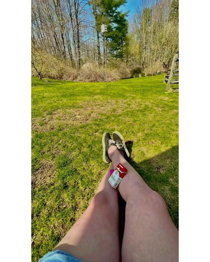 Officially so translucent you can see all the veins in my legs- evolution into invisible person almost complete. 🫥🥷🩸
