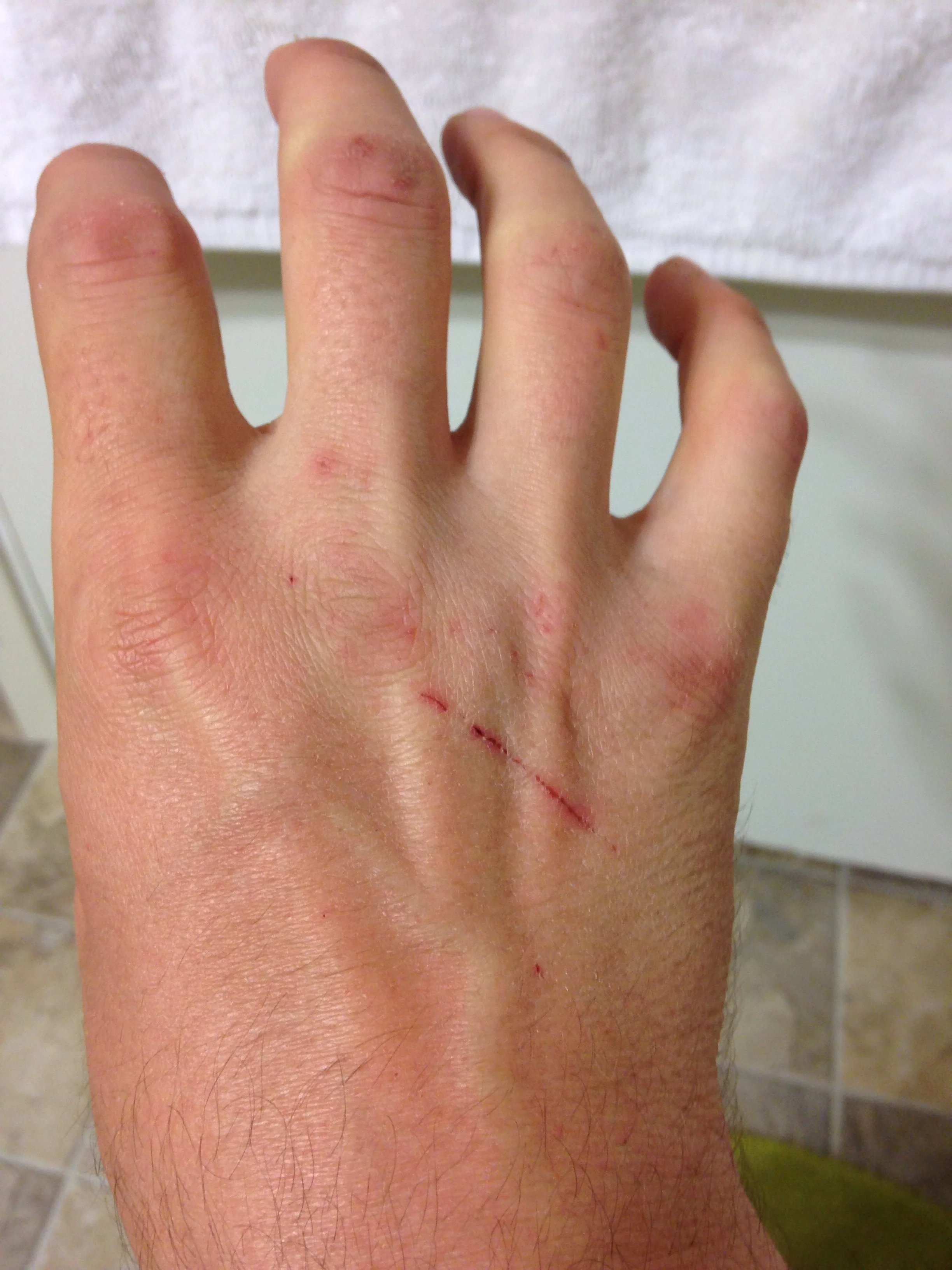 It took two full weeks and an inordinate amount of lotion for my poor hands to heal.