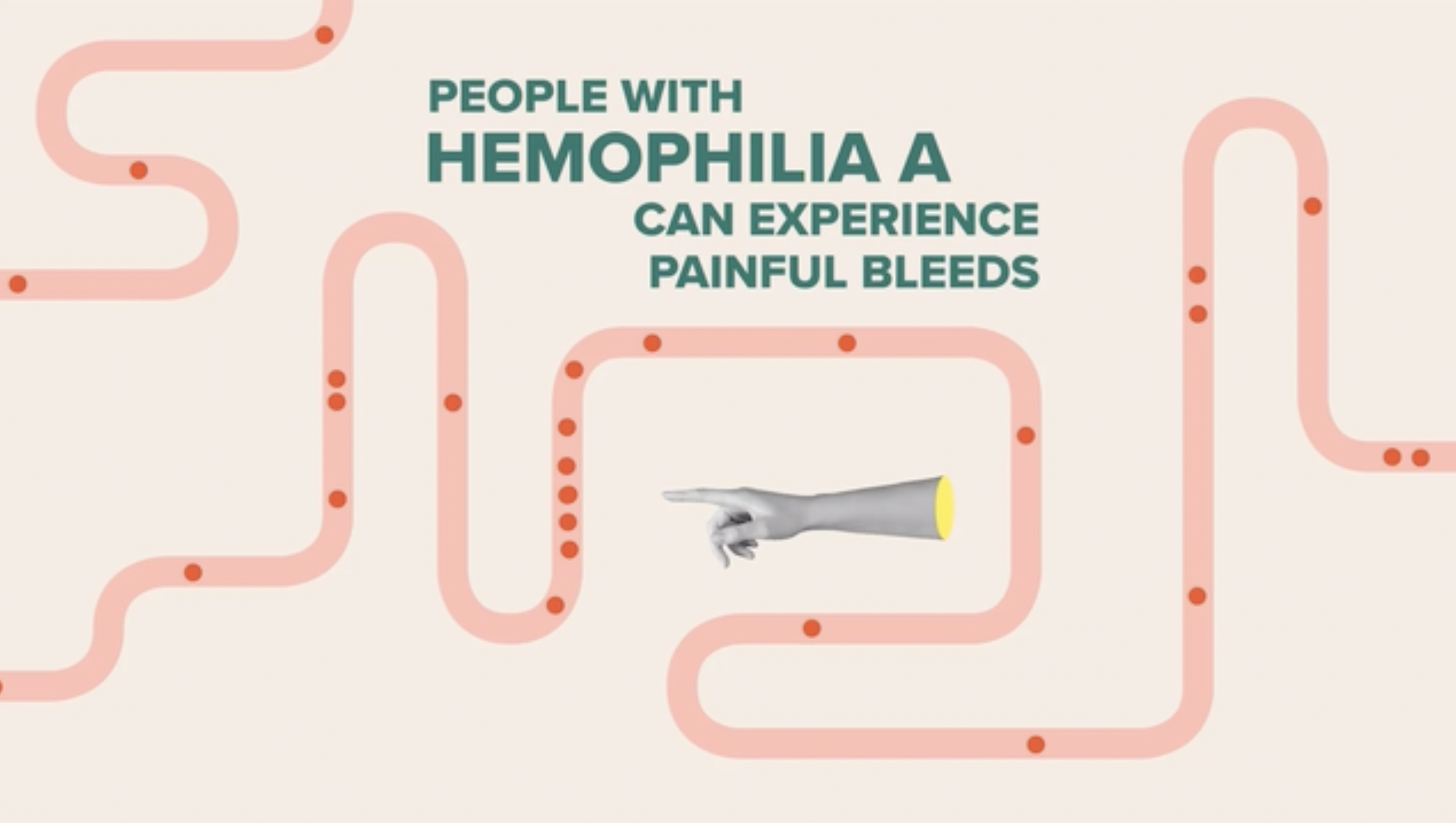 After decades, a scientific development has changed how people treat hemophilia A