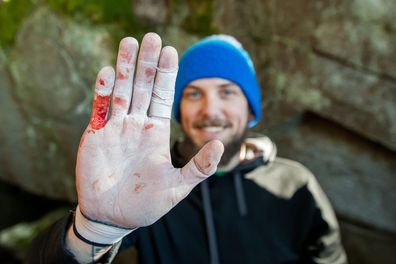 Derek Hamilton shows off his hands after bouldering in Gold Bar, WA.