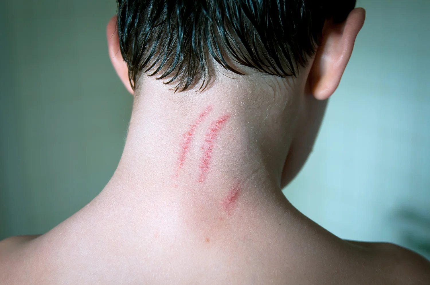   WonderLust  Kidmarks   Statement  