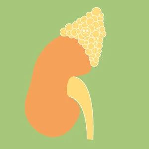 Signs of adrenal fatigue and 4 ways to help you restore balance