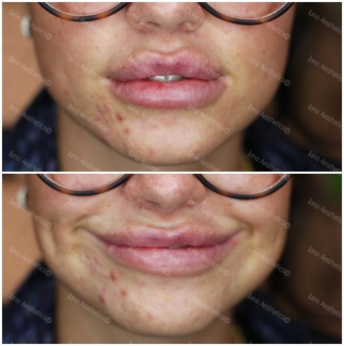 composite_15150824845202.jpg