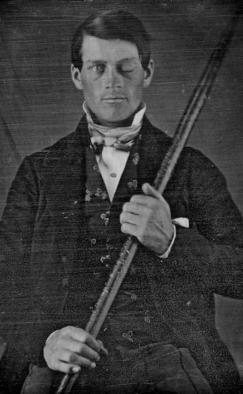 Phineas Gage with his iron rod.